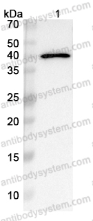 Anti-Clostridium perfringens plc/Phospholipase C/Alpha-toxin Polyclonal Antibody